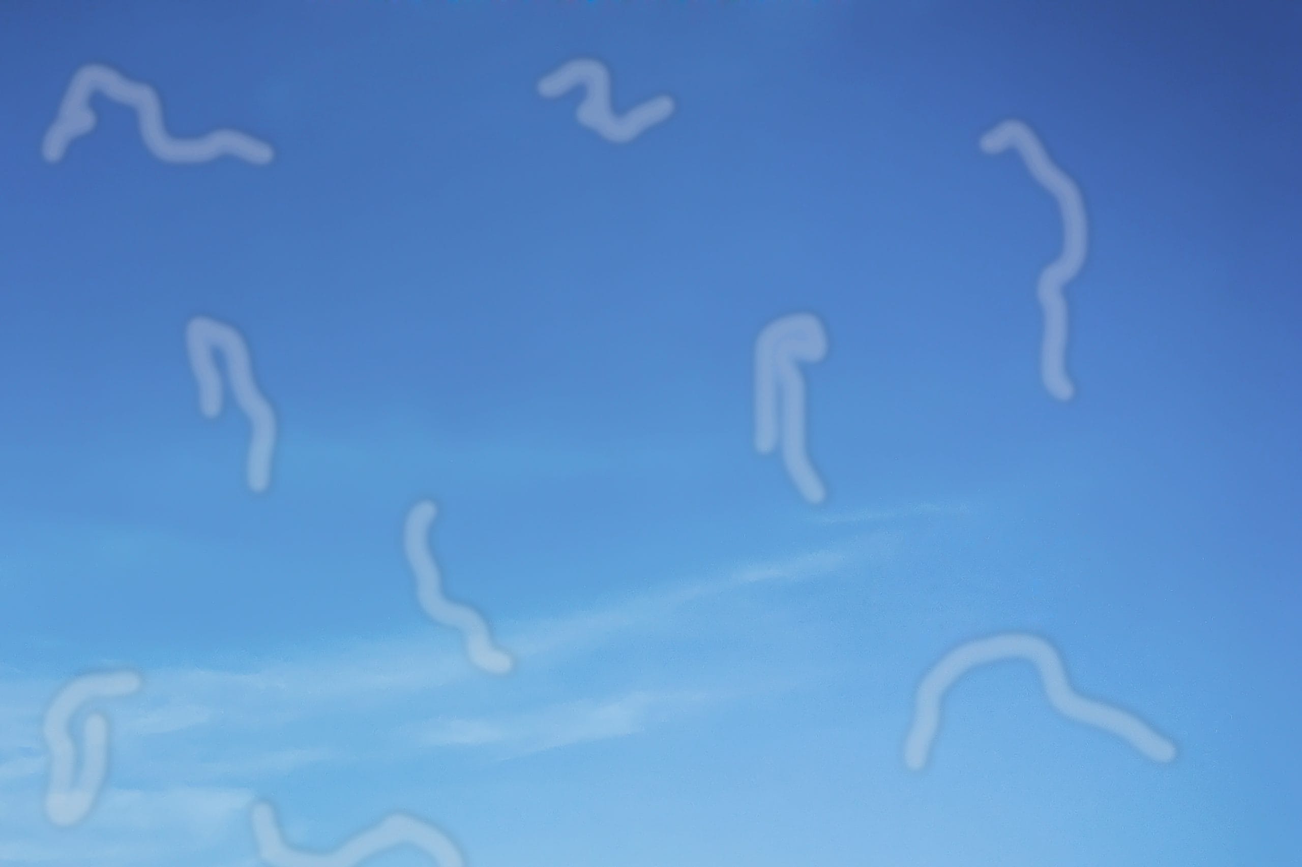 Eliminate Floaters With Advanced Laser Treatments